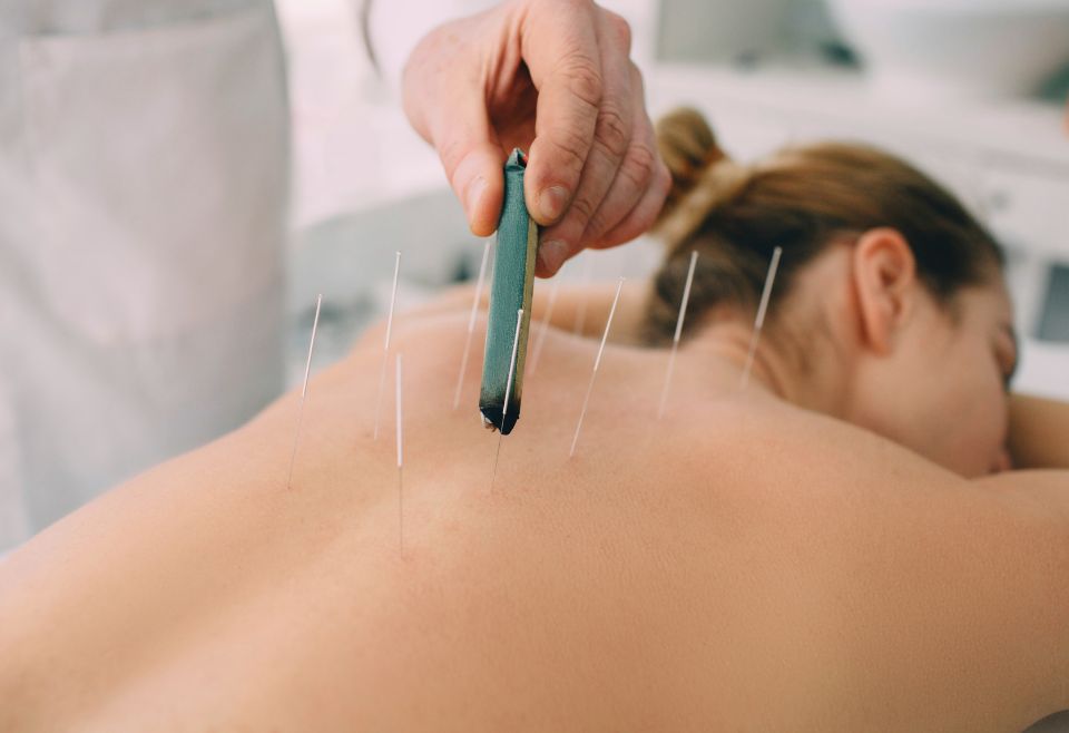 Cupping Therapy