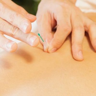 Seasonal Wellness: Harnessing the Power of Acupuncture in Winter