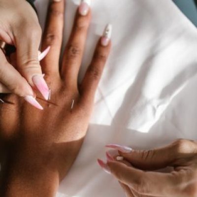 Acupuncture Benefits in Raymond: Core Health Expertise